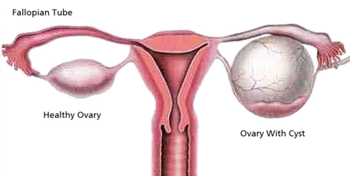 high risk pregnancy treatment